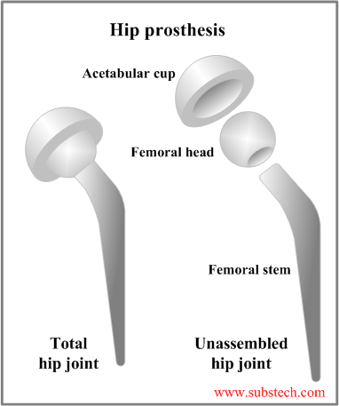 Hip prosthesis.png Hip prosthesis.png